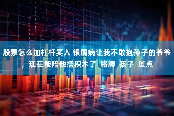 股票怎么加杠杆买入 银屑病让我不敢抱孙子的爷爷，现在能陪他搭积木了_胳膊_孩子_斑点